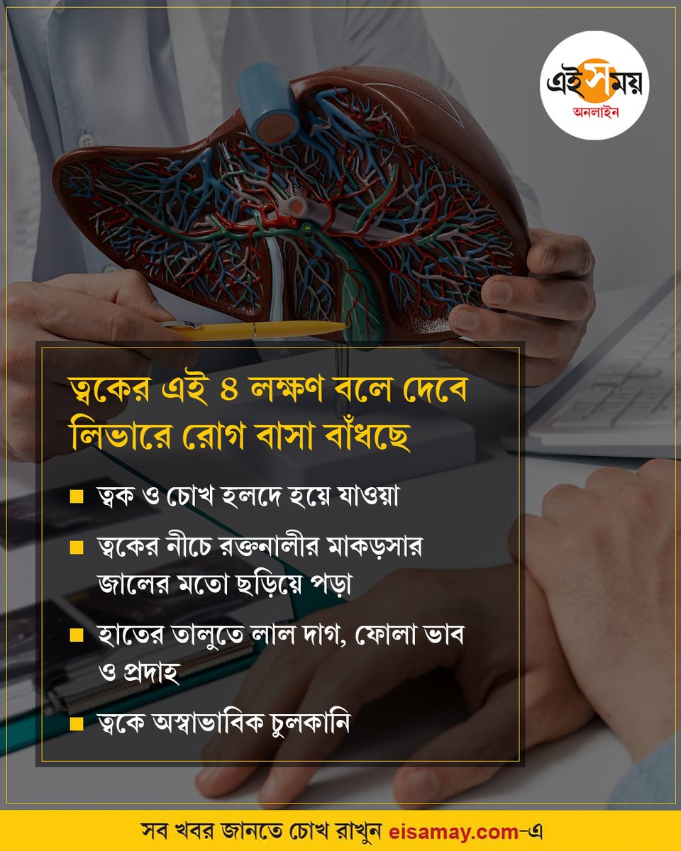 Ei_Samay's tweet image. ত্বকের এই ৪ লক্ষণেই সাবধান
#skinhealth #lifestyle #LiverProblem #healthylifestyle #eisamayonline #EiSamay