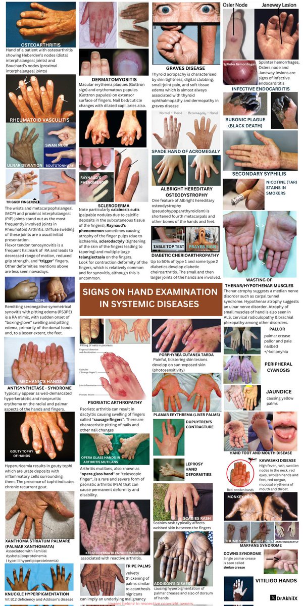 👋 HANDS in systemic disorders 

( excluding nail signs and dynamic signs)

An infographic