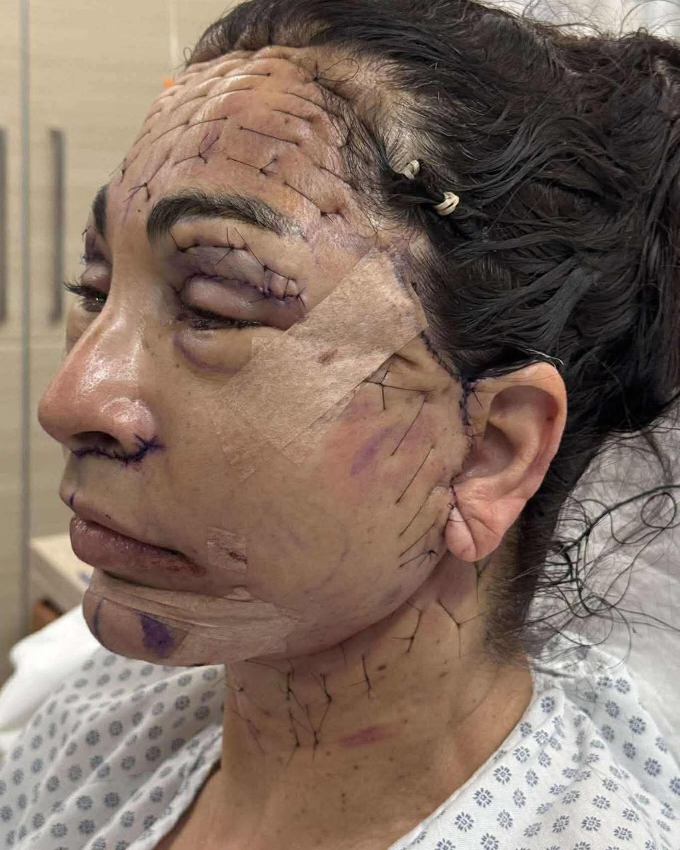 ما ضالل فيها شي ع حالو..🤣
عمليه تشويه ولا تجميل..🙂🙂 #صباح_الخير