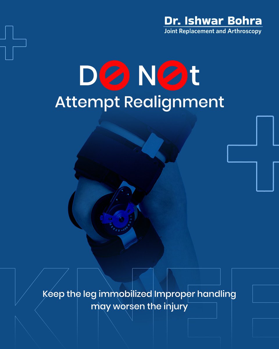 IshwarBohra0809's tweet image. A dislocated knee is a true emergency — it can damage blood flow, nerves &amp;amp; mobility if not treated fast.  Don’t try to fix it yourself. Get expert care immediately &amp;amp; restore movement with guided rehab. 
#KneeDislocation #OrthopedicCare #EmergencyCare #MobilityMatters