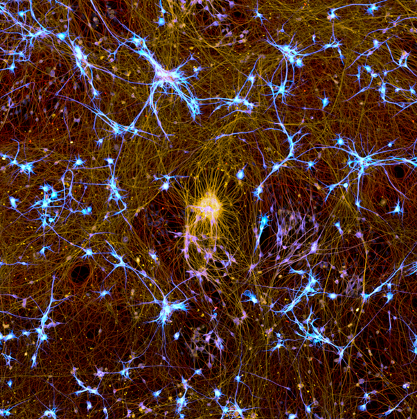 🥁 The winner of the 2025 BioTechniques Image Competition is… biotechniques.com/imaging/the-wi…

Keep an eye out for our follow-up interview with Bruno Cisterna (Medical College of Georgia at Augusta University) to learn more about this beautiful image!