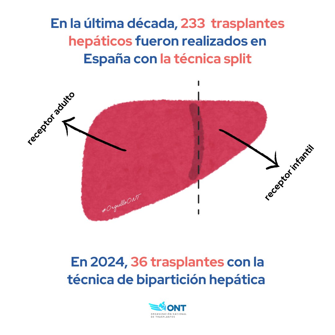 Organización Nacional de Trasplantes (@ont_esp) on Twitter photo ⚕️ Hace 33 años, el <a href="/vallhebron/">Vall d'Hebron</a> efectuó en #España la primera bipartición de un injerto hepático para trasplantar en un adulto y en un niño. Pero, ¿en qué consiste esta técnica? ¡Dentro hilo! 🧵 ⚕️ Hace 33 años, el <a href="/vallhebron/">Vall d'Hebron</a> efectuó en #España la primera bipartición de un injerto hepático para trasplantar en un adulto y en un niño. Pero, ¿en qué consiste esta técnica? ¡Dentro hilo! 🧵