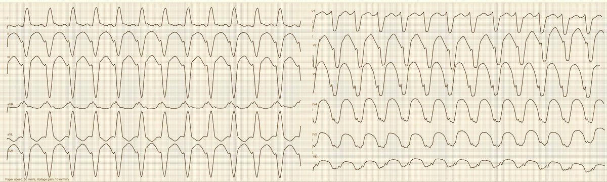 Dr. Andreas Roeschl tweet media