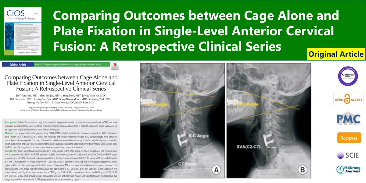 CiOSjournal's tweet image. Comparing Outcomes between Cage Alone and Plate Fixation in Single-Level Anterior Cervical Fusion: A Retrospective Clinical Series
🌷doi.org/10.4055/cios24…
2025 Jun;17(3) Jae-Won Shin
#Cervical_vertebrae #Kyphosis #Spinal_fusion #Adjacent_segment_pathology #Treatment_outcome