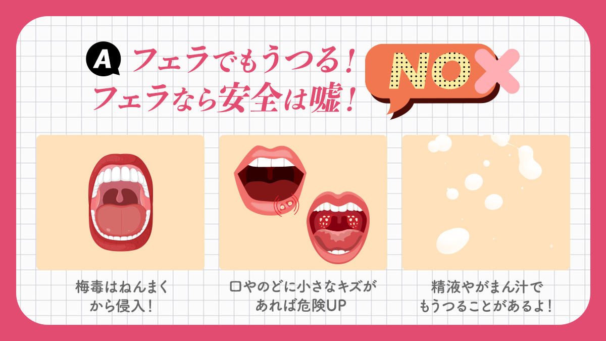 tokyo__himitsu's tweet photo. 梅毒はフェラでうつる？Yes or No ? #梅毒 #性病 https://t.co/yPoxNuByWR