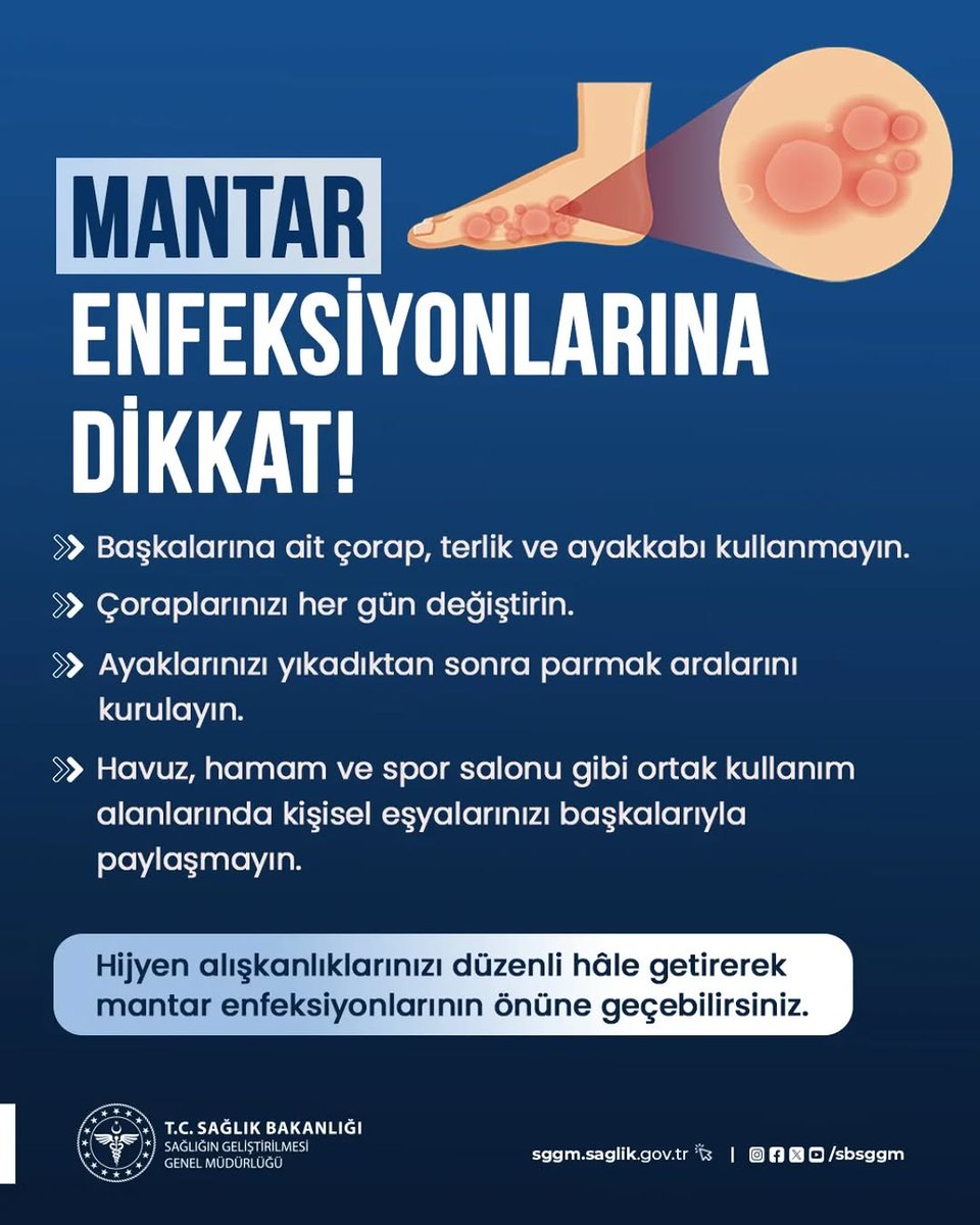 Ayak mantarı, kolayca bulaşabilen bir enfeksiyondur. Basit ama etkili önlemlerle sağlığınızı koruyabilirsiniz. #MantarEnfeksiyonları
