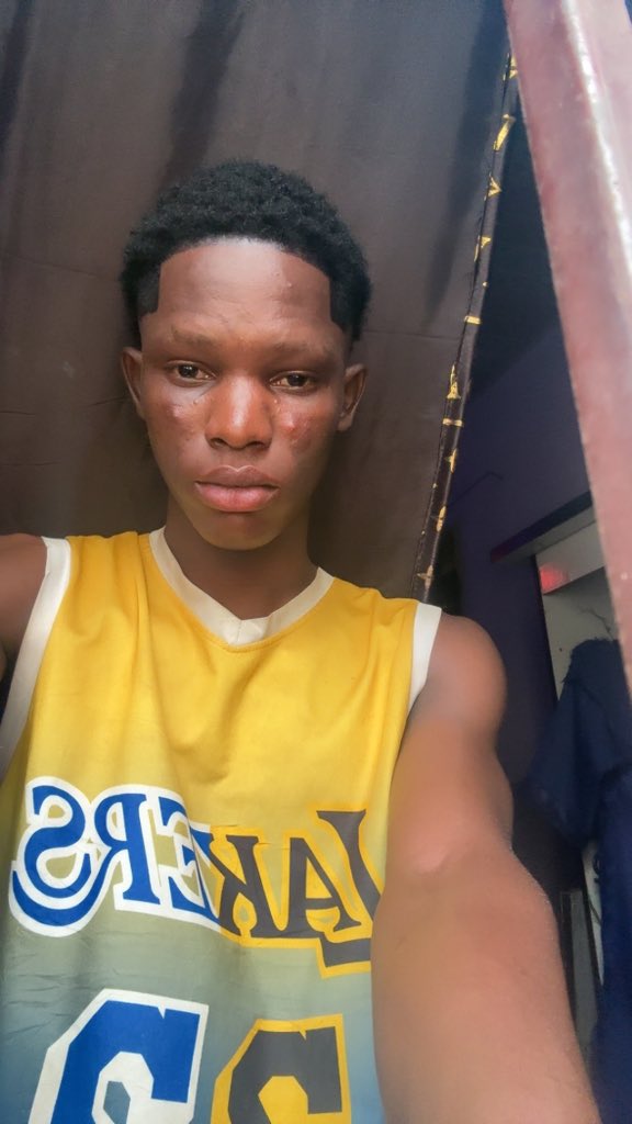 My gf said I look like Wizkid 🙈❤️