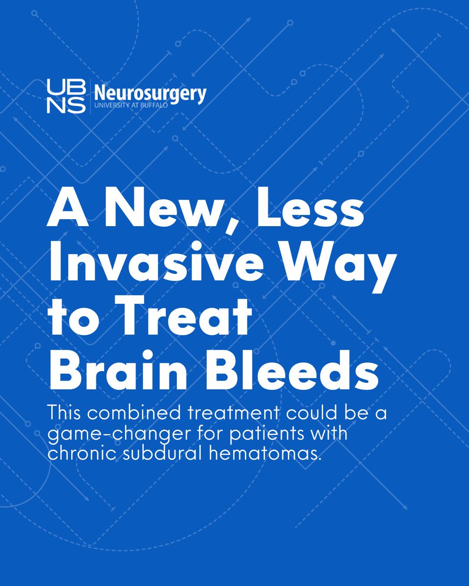 A new study evaluated the effectiveness of a less invasive treatment for chronic subdural hematomas.

Results show strong outcomes with fewer complications &amp; quicker recovery.
 
<a href="/jaims_lim/">Jaims Lim</a> <a href="/EladLevyMD/">Elad Levy</a> <a href="/JMDaviesMDPhD/">Jason Davies, MD,PhD</a> <a href="/_AdnanSiddiqui/">Adnan H. Siddiqui, MD</a> 

🔗: tinyurl.com/mrxnrjws?utm_c…