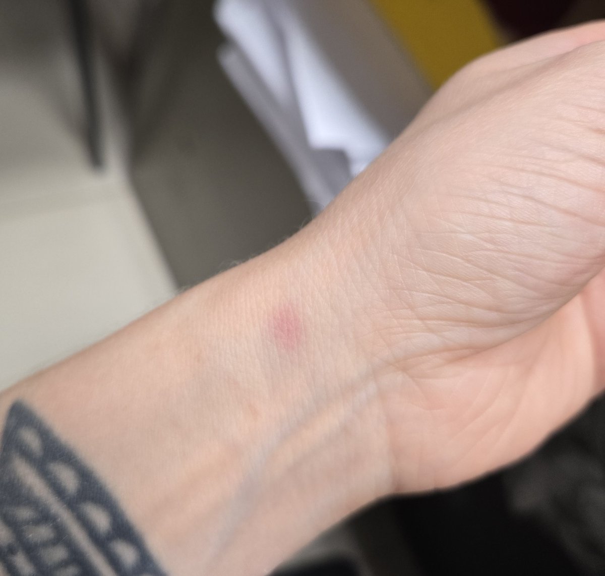 Пришла на работу - увидела синяк,утром его не было. А теперь он еще и сам покраснел