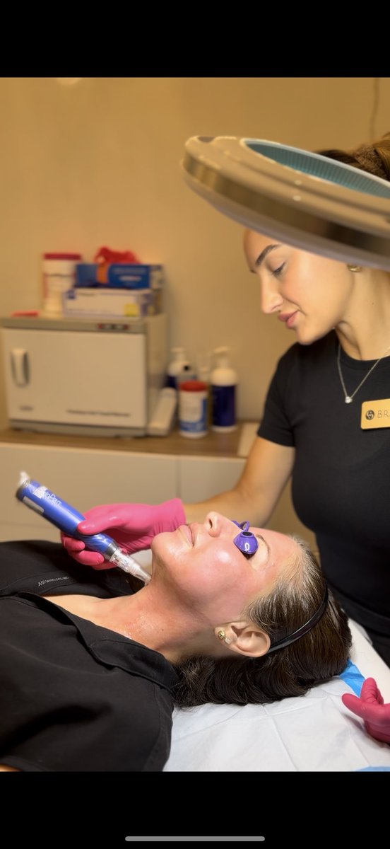 Microneedling is the treatment for all skin types and all seasons. Fade dark spots, scars, dark circles, fine lines, acne and boost collagen for firmer skin. Book your Microneedling series at skinCARE Medspa for your best skin yet. ✨

#skinpen #raleigh #medspa