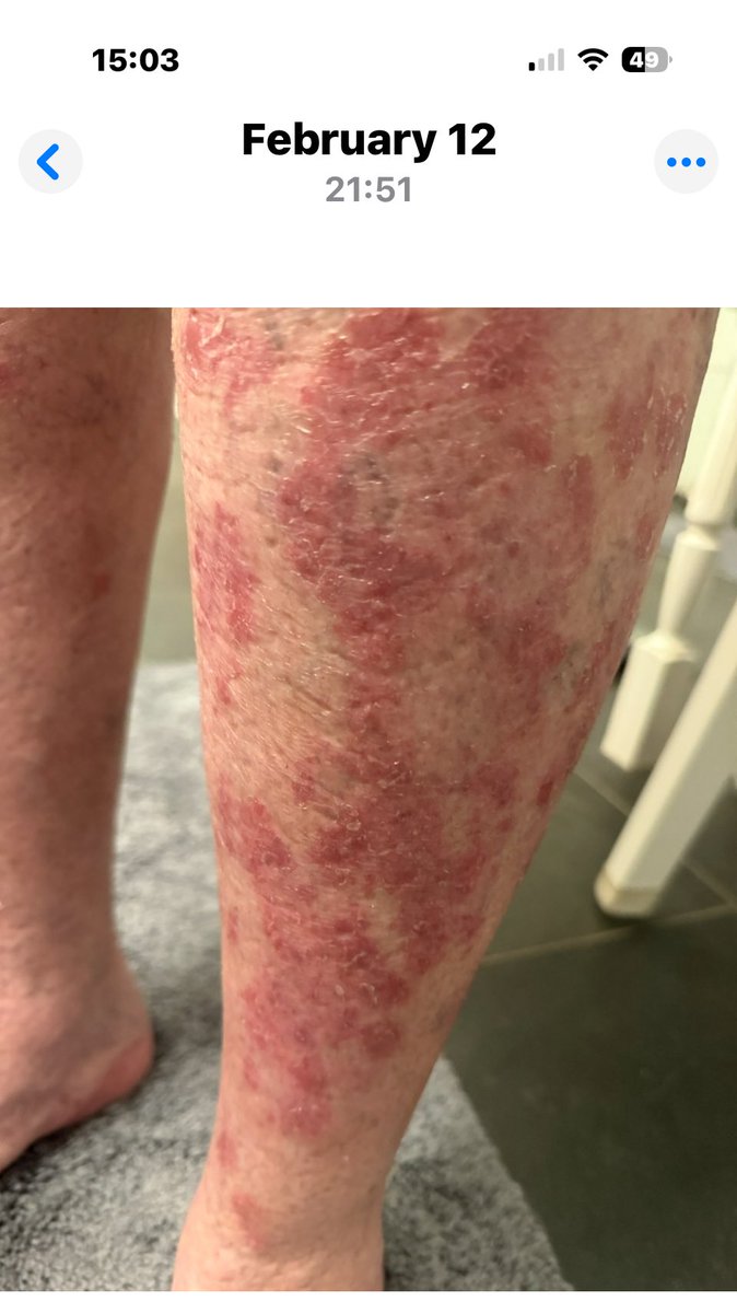 Nutmegbunny tweet media