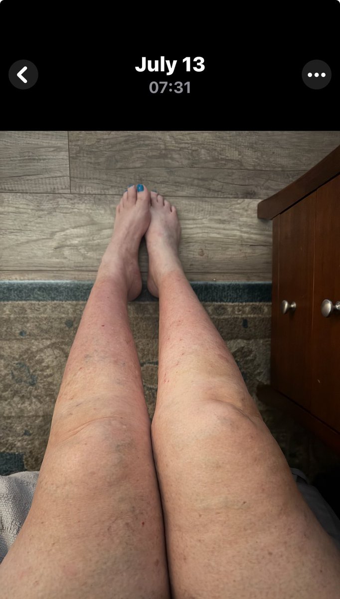 Nutmegbunny tweet media