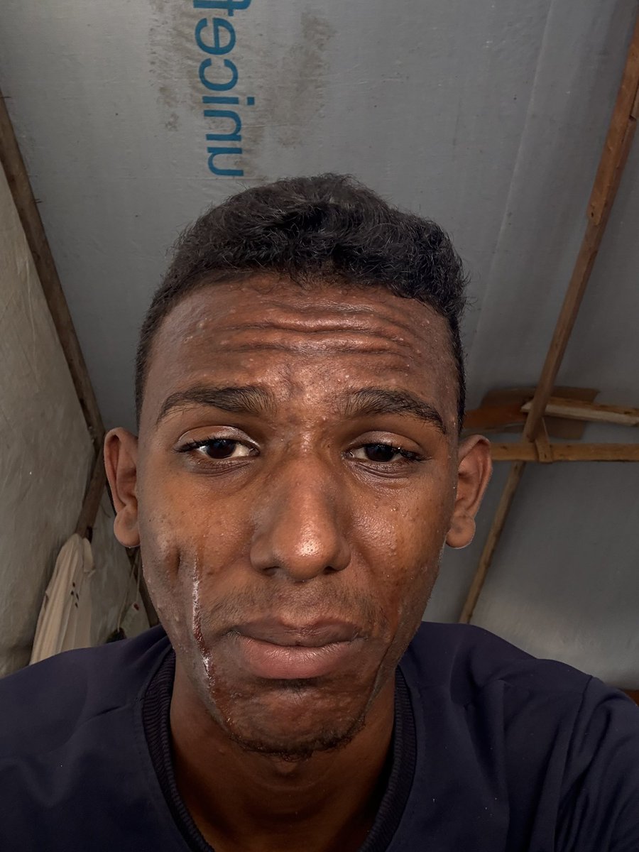 I'm so hungry .. but does it even matter?  
If you see this, reply with a dot.and repost

gofund.me/64fec104