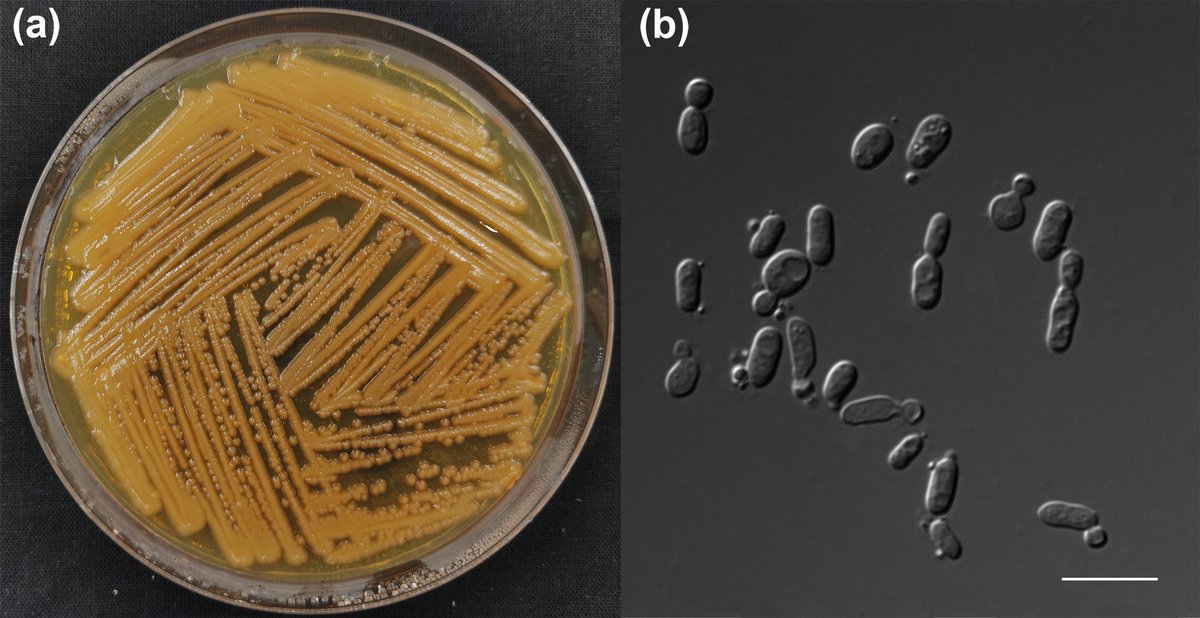 MicrobioSoc's tweet image. Rhodotorula silvicola sp. nov., a new yeast species from plant-associated substrates and mushroom. Published Open Access and fee-free in IJSEM using a Publish and Read agreement: doi.org/10.1099/ijsem.… #IJSEM #PublishAndRead