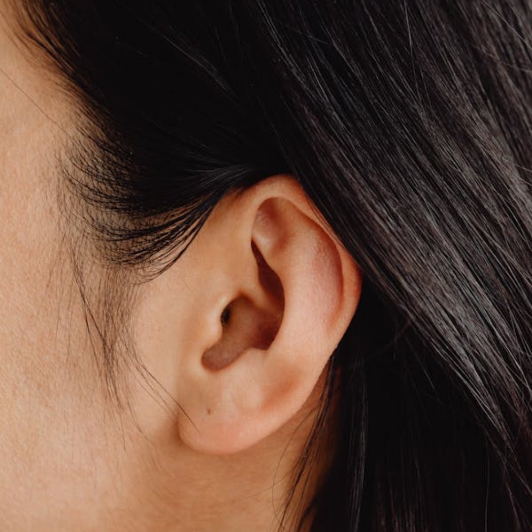 🔬 Accessing viable human inner ear cells for research has always been a major hurdle in #HearingScience. But #SICHL has pioneered a way to collect viable inner ear cells from organ donors.

Support the groundbreaking research making this possible:
stan.md/4ek8Ku5