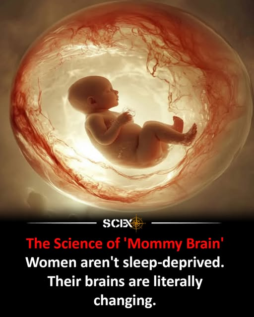 GrzesioHetman's tweet image. Nauka o "mózgu mamusi"
Badania pokazują, że ciąża i wczesne rodzicielstwo przynoszą strukturalne i funkcjonalne zmiany w mózgu, takie jak zmniejszenie istoty szarej i wzmocnienie ścieżek neuronowych związanych z przetwarzaniem emocji i empatią. #MommyBrain  #PregnancyScience
