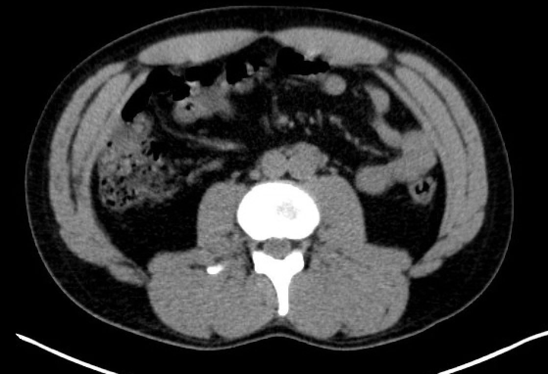 Rangarajan Purushothaman tweet media