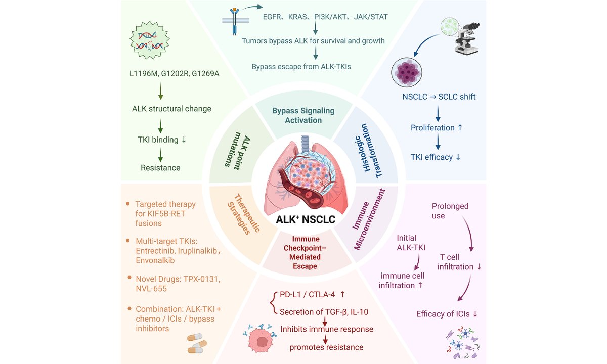 cdrjournal's tweet image. 📢 Newly Published Review in #Cancer #DrugResistance
 
How can we overcome #ALK-targeted #therapy resistance in #LungCancer?

📖 Read for free: oaepublish.com/articles/cdr.2…
🔗Download PDF: f.oaes.cc/xmlpdf/publish…