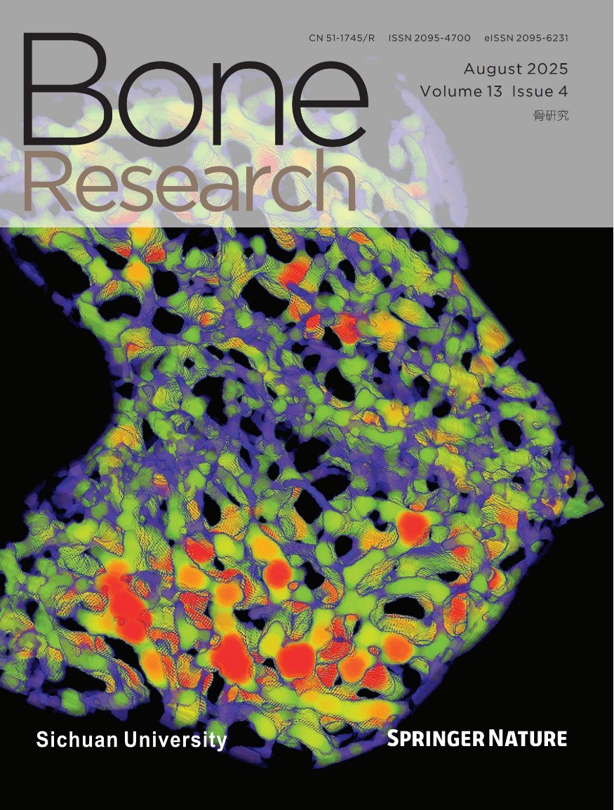 BoneRes_Office's tweet image. Cover image showing pseudo-colored trabeculae of the Sost -/- proximal tibiae, highlighting how bone thickness varies, measured by µCT. This cover image was contributed by @DrScottJRoberts , the Royal Veterinary College, London, UK.🥳
@BoneRes_Office 
nature.com/articles/s4141…