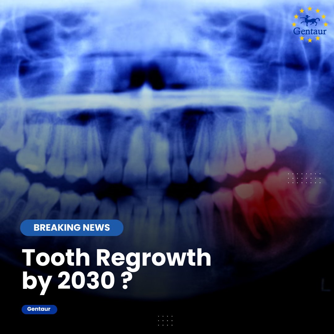 🔬 Japonia rozpoczęła pierwsze badania kliniczne leku, który pozwala odrosnąć zębom poprzez blokowanie USAG-1 (SOSTDC1).
Do 2030 r. może być naturalną alternatywą dla implantów i protez. 🦷
#Gentaur #ToothRegrowth #RegenerativeMedicine #ClinicalTrials