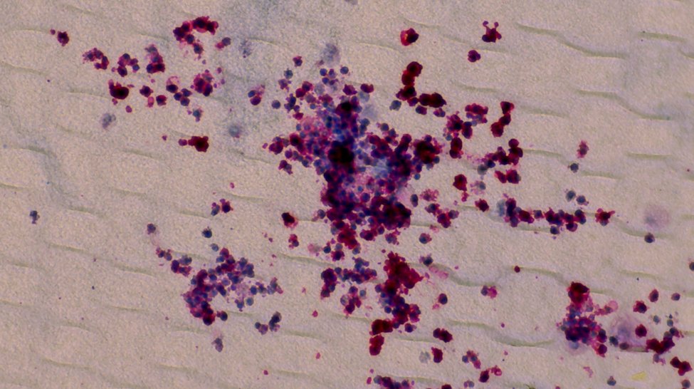 🚨 New paper! Mohamed Shoeb <a href="/shoeb_mo92/">Mohamed Refaat Shoeb</a> from our team together with Klaus Fortschegger and Sabine Strehl's group <a href="/StAnna_CCRI/">St. Anna Children's Cancer Research Institute CCRI</a>, just out in <a href="/CommsBio/">Communications Biology</a>: 
"A stem cell differentiation model reveals two alternative fates in CBFA2T3::GLIS2-driven AMKL" 
🔗 doi.org/10.1038/s42003…