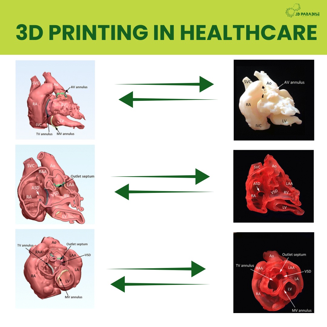 paradise_3d's tweet image. From digital scans to real models – 3D printing is transforming healthcare.
These 3D printed heart models help doctors plan surgeries with greater precision &amp;amp; safety.

🌐 paradise-3d.com

#3DPrinting #Healthcare #3DParadise #MedicalInnovation