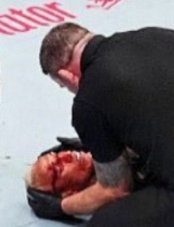 اكتب من القيفان مافيه تذكار
ربع يسرك فعلهم والعلامي

ابكي على ربعي بعيدين الاذكار
اهل السموت ولابسين التوامي

امس وهم عندي جلوس وحضار
واليوم فوقهم النصايب علامي

راحوا ولا منهم على الخد ديار
ولحد على الدنيا مقيم دوامي