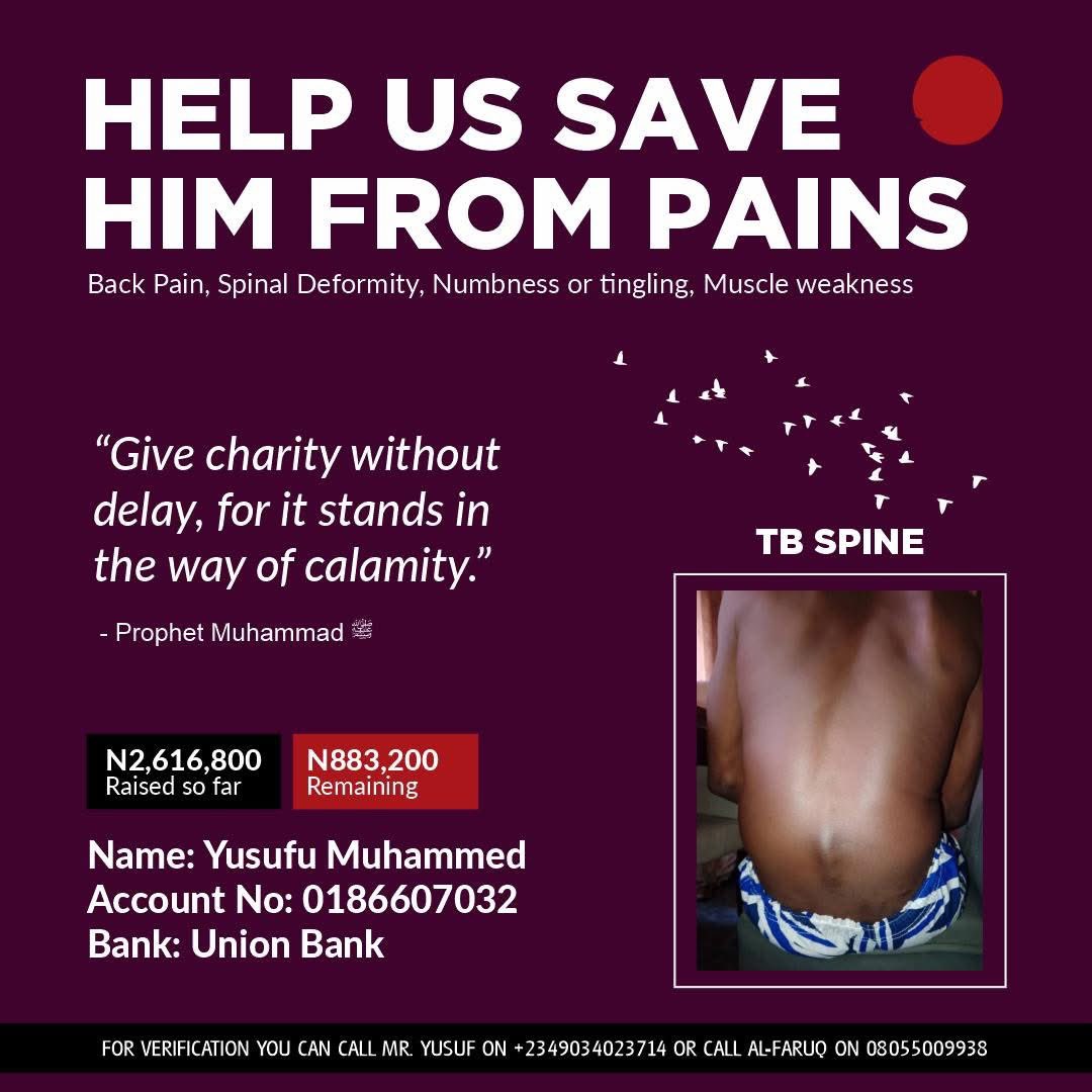 After raising about 2.6 million Naira for the father who needed surgery on the bone of his spine, we deposited it to the hospital and surgery was successfully done yesterday.

The man can now sit, walk and stand without pain, Alhamdulillah.

He is presently recovering but we
