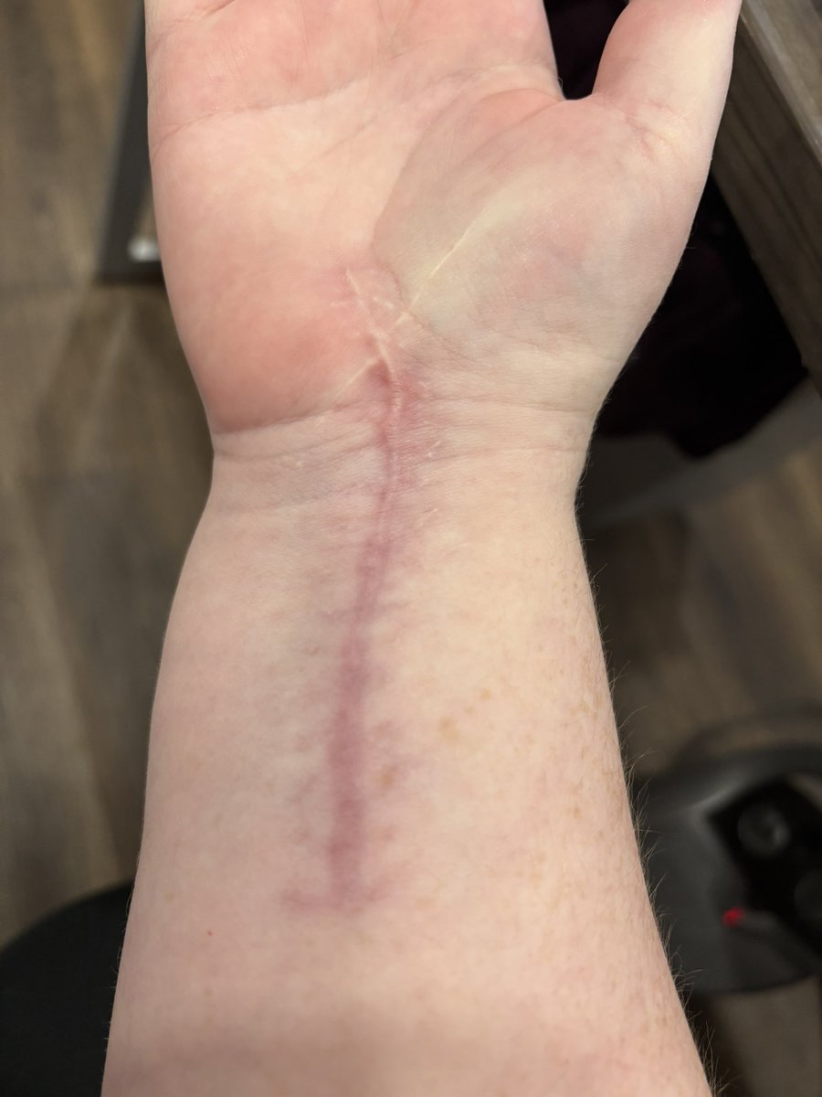 Scar is looking better but goodness it looks like a battle wound 😂

Fun fact: the other scar is from one of my cats 🥴