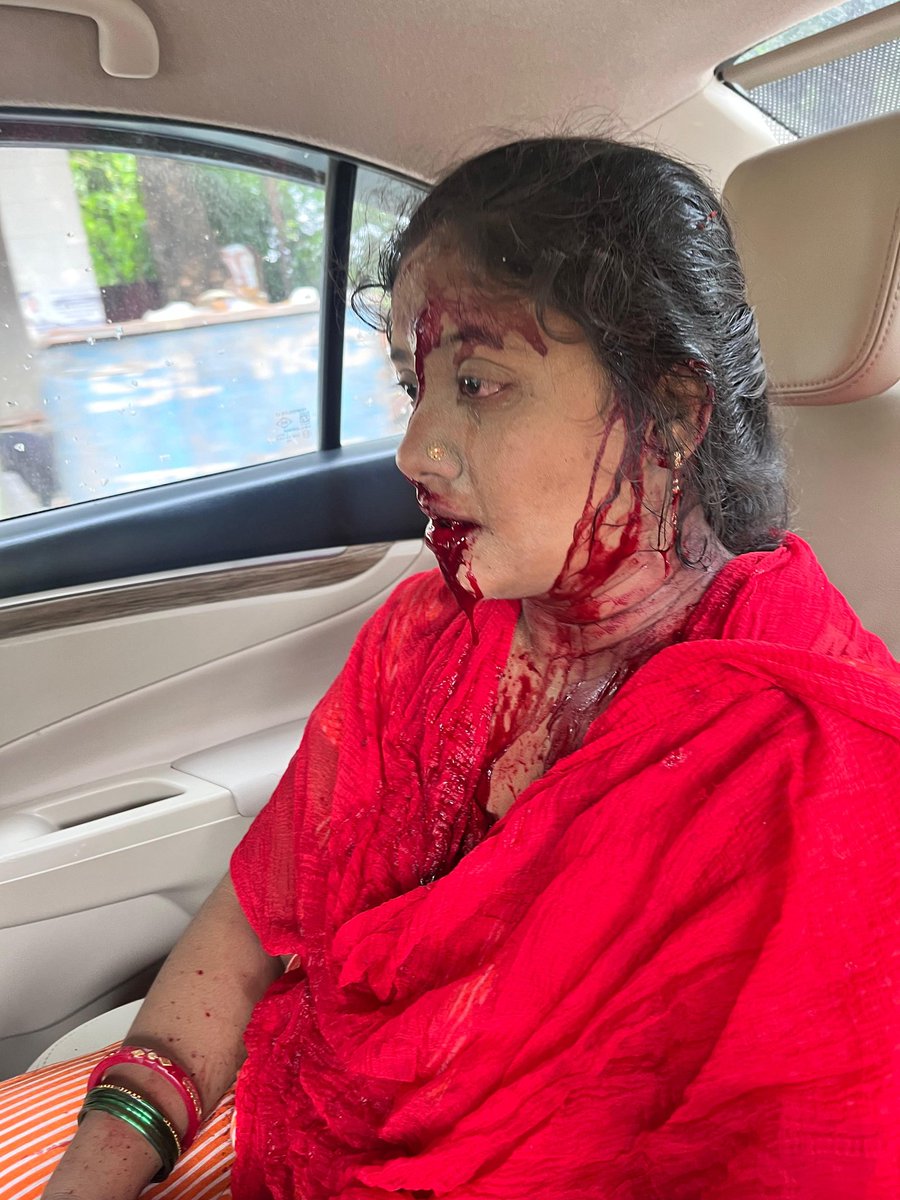 amicable982's tweet photo. @mlkhattar This is pathetic situation in sector 7 pushp vihar govt quarters. Criminal negligence from CPWD and Mouha. https://t.co/g1CuUCuiL6