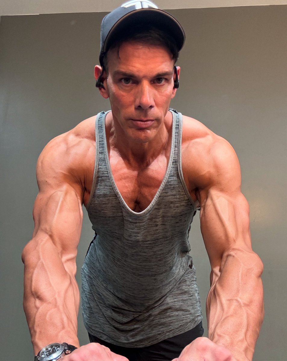 Frank Sepe (@franksepe) on Twitter photo Quick progress pic #๐
#237.9lbs - Feel Amazing ๐ฏ
Thrilled to have <a href="/TranscendHRT/">Transcend Company</a> supporting me on this journey! I can't wait to share the entire process with you all! #chetsday
โ
Click Link In My Bio ๐ฏ
#health #partner #team #franksepe #beyou #fitnessjourney Quick progress pic #๐
#237.9lbs - Feel Amazing ๐ฏ
Thrilled to have <a href="/TranscendHRT/">Transcend Company</a> supporting me on this journey! I can't wait to share the entire process with you all! #chetsday
โ
Click Link In My Bio ๐ฏ
#health #partner #team #franksepe #beyou #fitnessjourney