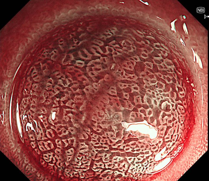 Keith Siau tweet media