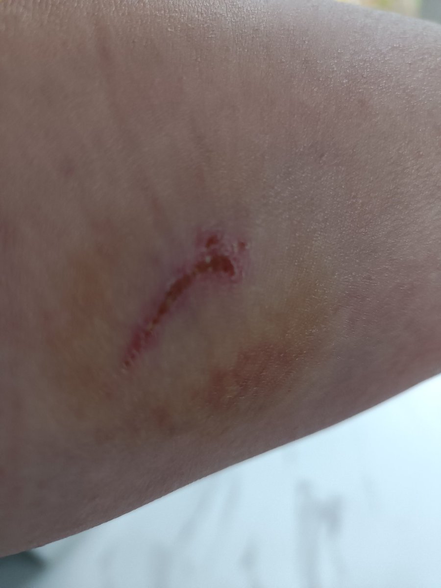 It's Friday!!!!!! No chat from Da Boss - we're on hollibobs but a picture of the first 'war wound', firewood we were chopping, fought back Mrs Mead said a naughty word (or 10!) &amp; it got her for the 2nd time in the shower later! Have a very meady weekend folks 🥂

#mead #holiday