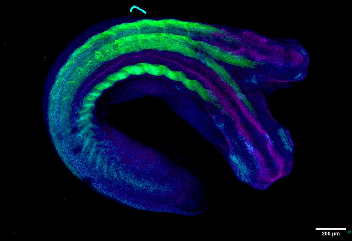 SocDevBio's tweet image. 🔬Two heads are better than one… even in frogs! 🐸✨
This Xenopus laevis embryo developed with two heads, offering a striking view of early developmental patterning.
🟢 actin 🟣 neural tissue 🔵 nuclei. Image by Kourtnie Whitfield. #FluorescenceFriday #DevBio #Xenopus
