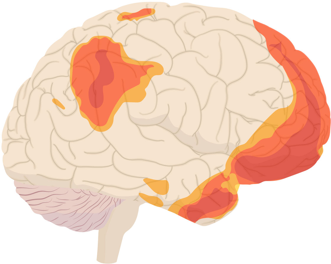 The highlighted brain regions shown here become more active when we’re doing nothing. This “default mode network” is associated with internal cognitive experiences including memory, experience replay, and action consideration. quantamagazine.org/what-your-brai…