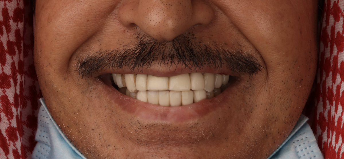 سعود الحميدان tweet media