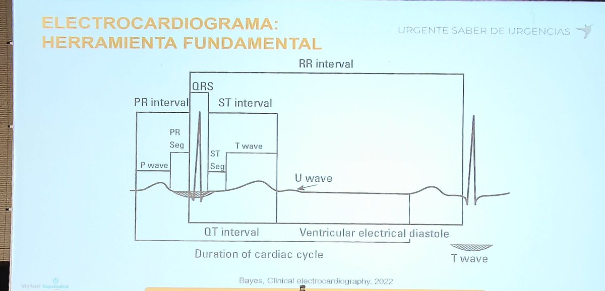 El EKG en SCA es una herramienta vital durante el enfoque del SCA dado que es la herramienta más barata, disponible y con alta sensibilidad que pueden relacionarse con un trastorno eléctrico o de isquemia y debe realizarse en los primeros 10 minutos ! #saberdeurgencias