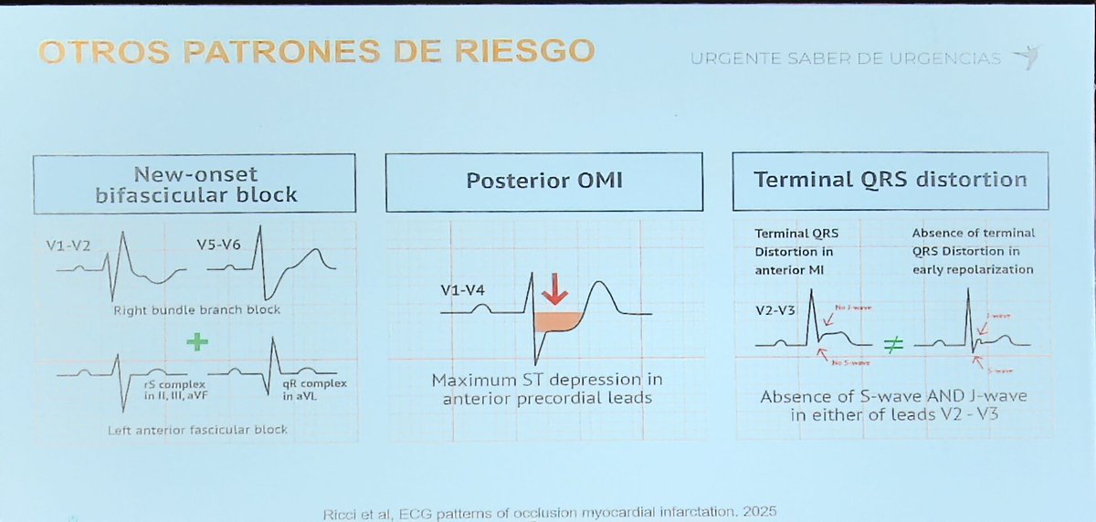 Siempre que haya depresión del ST entre V1 y V4 en contexto de dolor toracico debe sospecharse elevación del ST en región posterior #saberdeurgencias