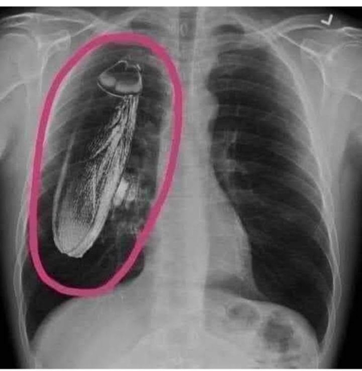 There is an explanation, but what is it?