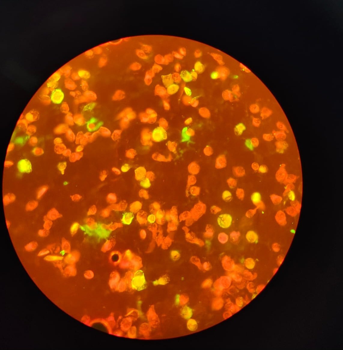 Se ven las células fluorescentes brillantes infectadas por el Herpes Virus. Gentileza <a href="/LaboratorioAzul/">Laboratorio Azul</a>
