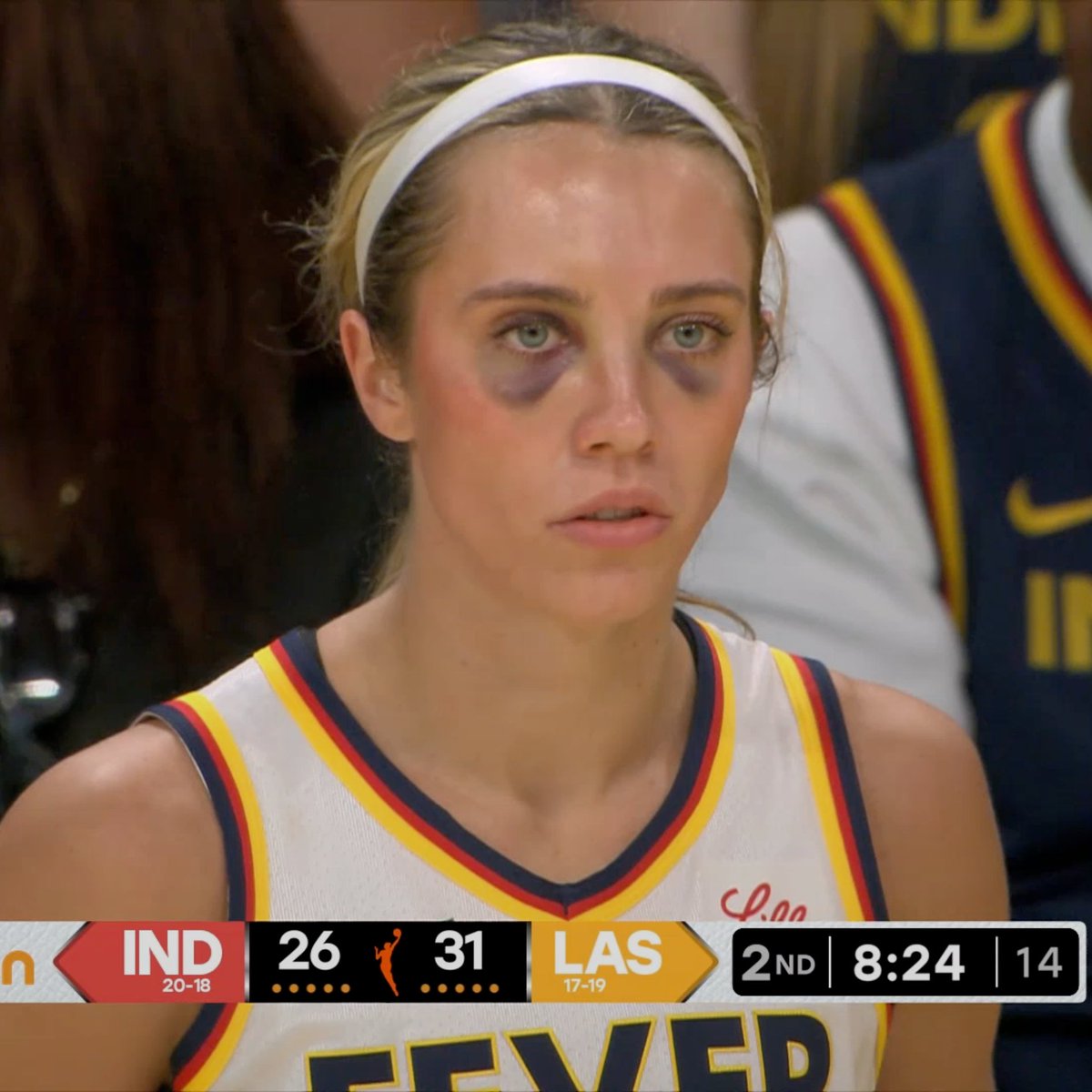 ShowCaseShabazz's tweet image. 😭😭 ??