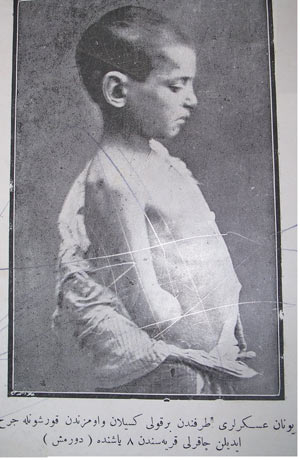 𝐨̈𝐳𝐫𝐮𝐦𝐞𝐥𝐢 (@yeniozrumeli) on Twitter photo Yunan Askerleri tarafından kolu kesilen 🇹🇷Türk Çocuğu-İzmir 1920
Turkish boy arm cut off by Greek soldiers Izmir, Turkey 1920
Έλληνες στρατιώτες έκοψαν το χέρι ενός Τούρκου αγοριού Σμύρνη, Τουρκία 1920 Yunan Askerleri tarafından kolu kesilen 🇹🇷Türk Çocuğu-İzmir 1920
Turkish boy arm cut off by Greek soldiers Izmir, Turkey 1920
Έλληνες στρατιώτες έκοψαν το χέρι ενός Τούρκου αγοριού Σμύρνη, Τουρκία 1920