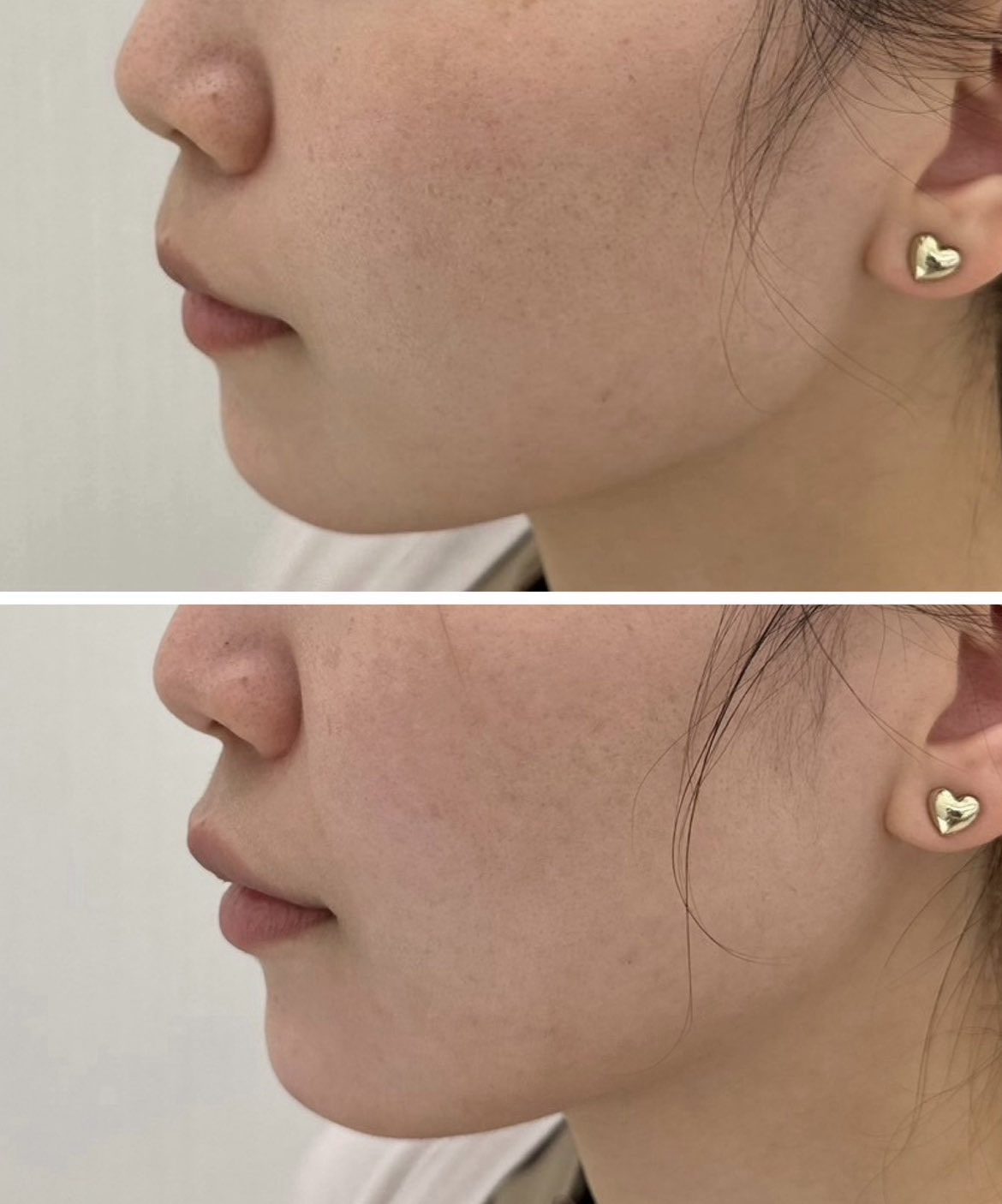 美容皮膚科369clinic(ミロククリニック) (@369clinic) / X