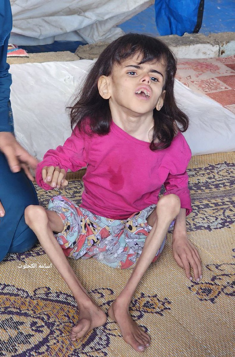 Look at this little angel girl, she is starving 💔

If you see this pic, reply with 🇵🇸 💔