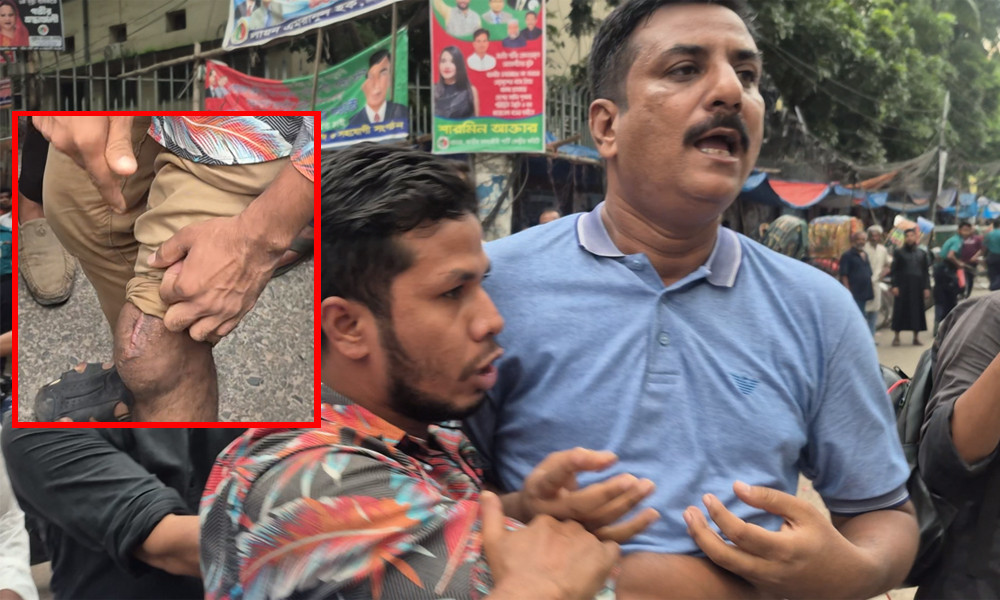 ‘উনিই আমার পায়ে ৪ আগস্ট গুলি করেছে, উনাকে আমি ছাড়ব না’