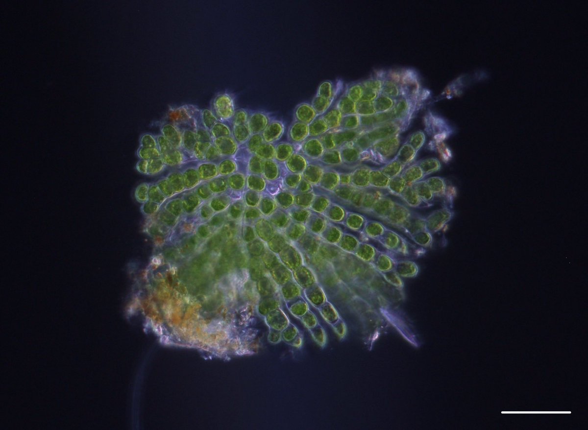 琵琶湖のササバモに着生していました。これもColeochaeteの一種なのでしょうか？(スケールバーは50 μm)