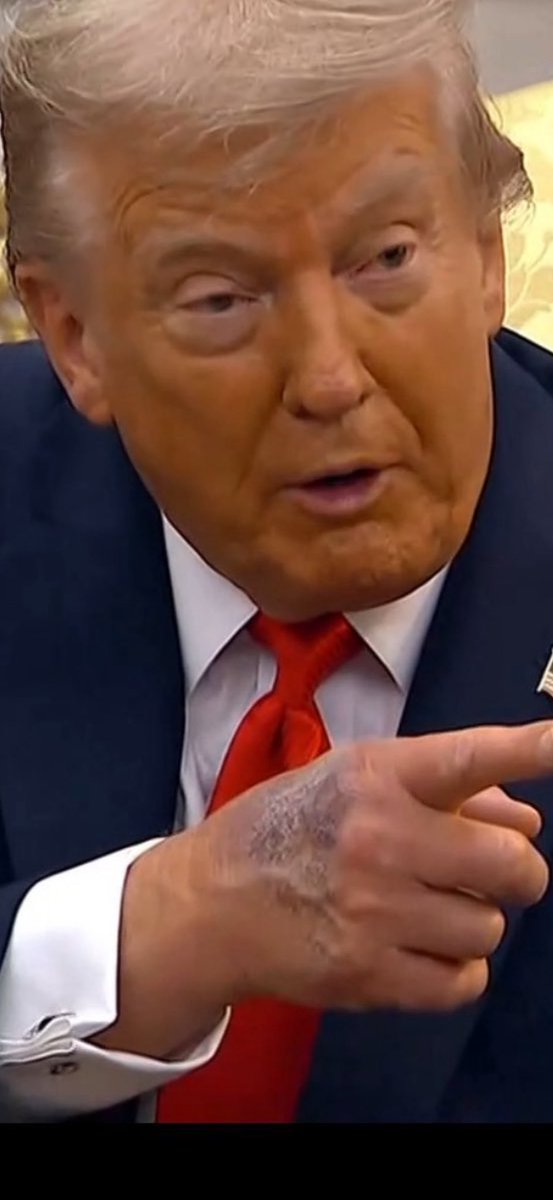 Trump is alive and playing golf? 

Back to Plan B. 

#LetsGoBloodClot