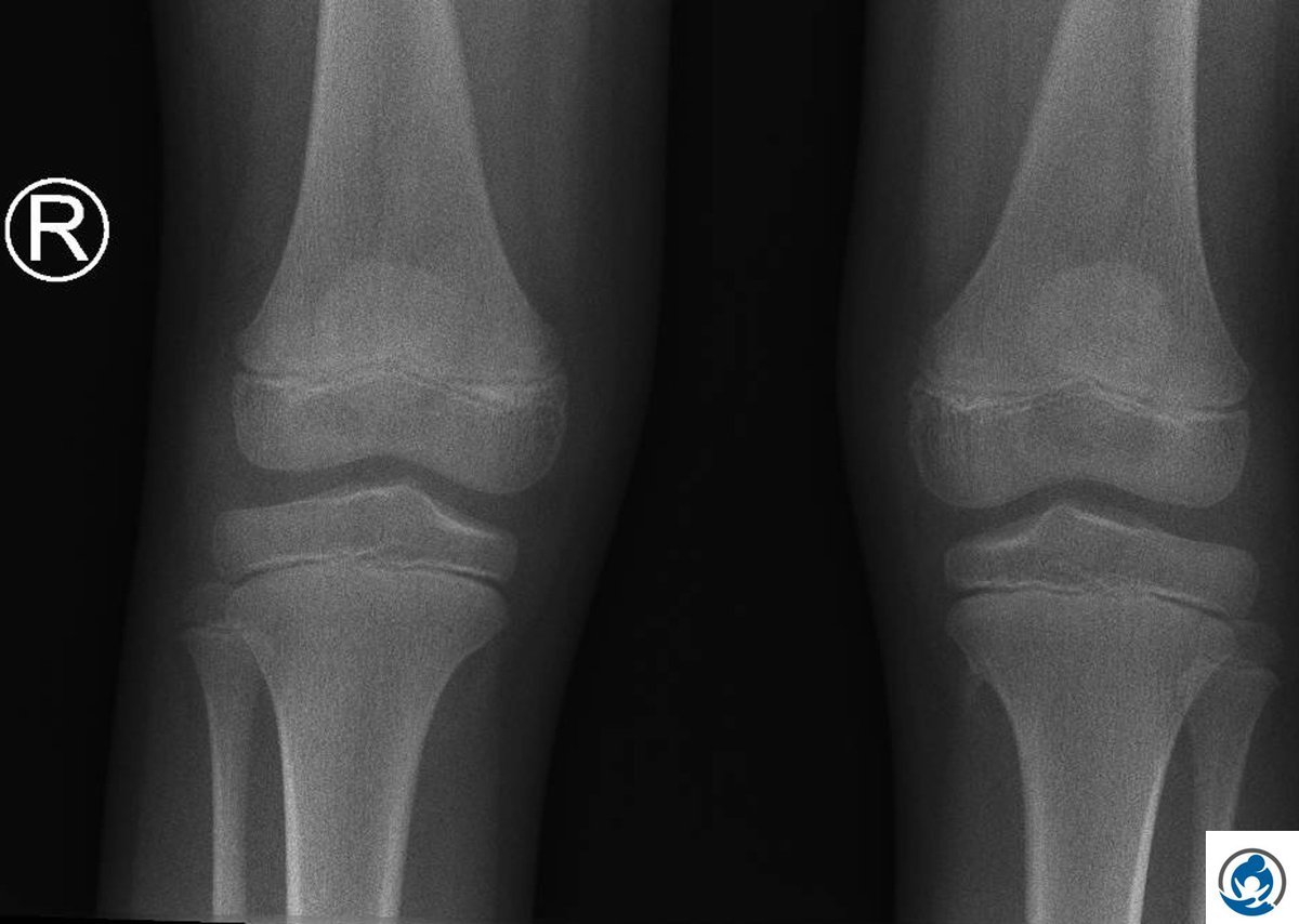 Pediatric Radiology Essence tweet media