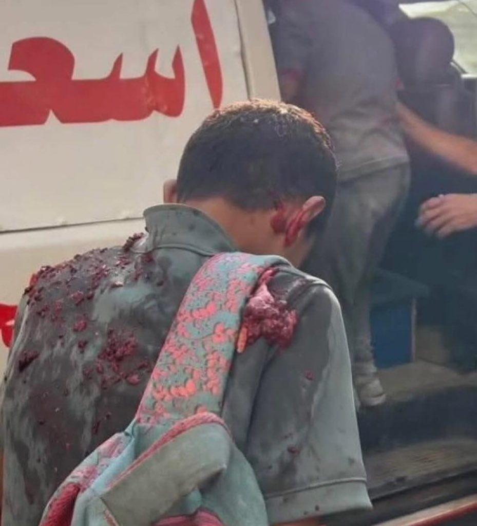 Gazze’de akıl almaz derecede zor bir gün yaşanıyor. Vahşi katliamlar bir saniye bile durmuyor. 

Fotoğrafta bombardıman sonrası aile üyelerinin vücut parçaları üzerine bulaşmış bir çocuk görüyorsunuz.

Nasıl anlatalım durumun vahametini?
Kime, nasıl duyuralım?

#GazaGenocide