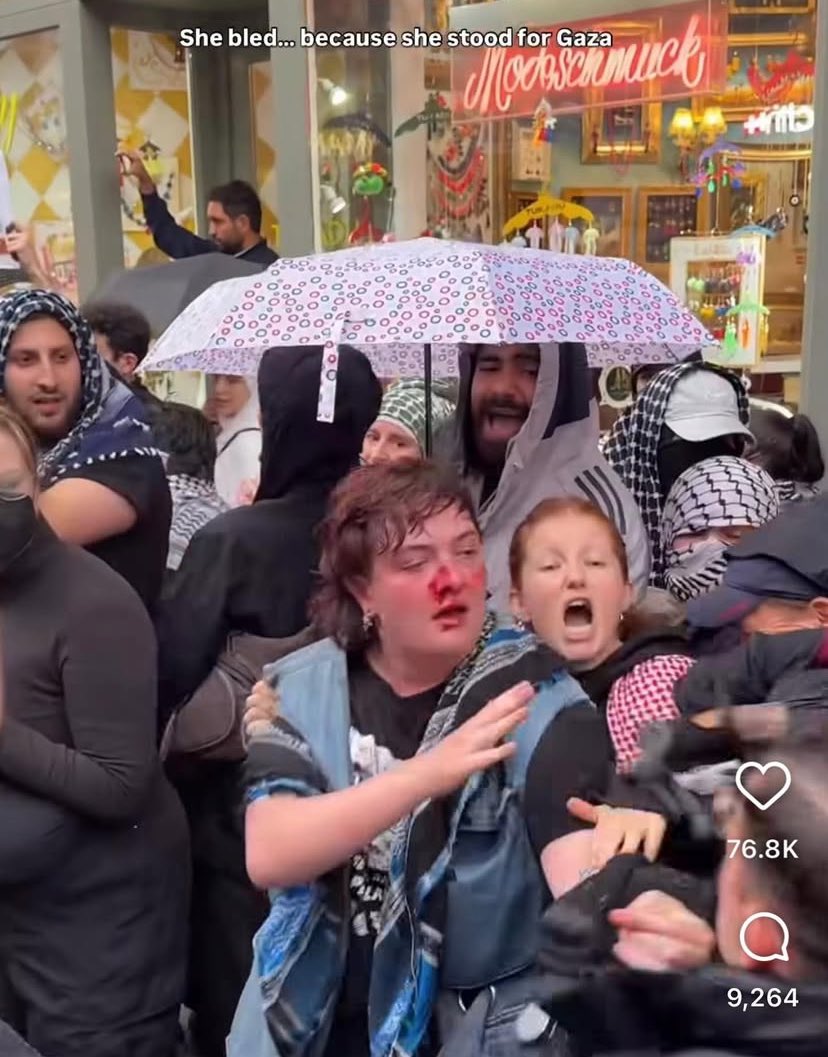 Ruth Coppinger (@ruthcoppingersp) on Twitter photo Solidarity with Kitty O’Brien, punched & assaulted by German police for standing with Palestine & against genocide. Incredible to think European countries are becoming police states & adopting fascistic methods. <a href="/SimonHarrisTD/">Simon Harris TD</a> must register protest with German govt. #kittyobrien Solidarity with Kitty O’Brien, punched & assaulted by German police for standing with Palestine & against genocide. Incredible to think European countries are becoming police states & adopting fascistic methods. <a href="/SimonHarrisTD/">Simon Harris TD</a> must register protest with German govt. #kittyobrien